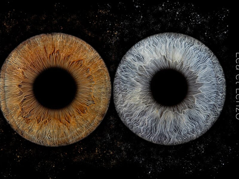 Photographie artistique de deux iris humains côte à côte, l'un marron cuivré, l'autre bleu-gris, sur fond noir étoilé