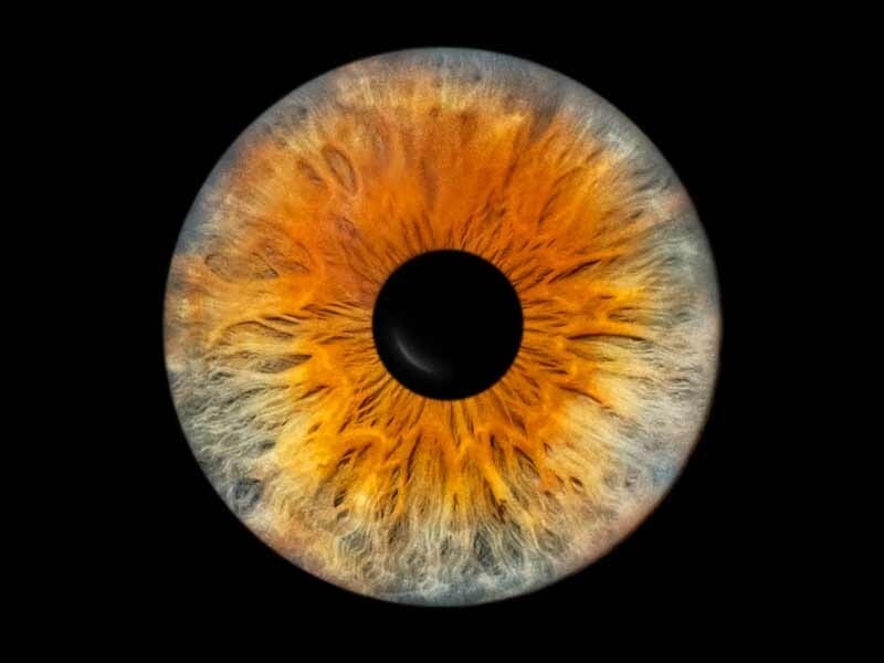 Gros plan sur un iris humain aux teintes orange et bleues, avec une pupille noire au centre