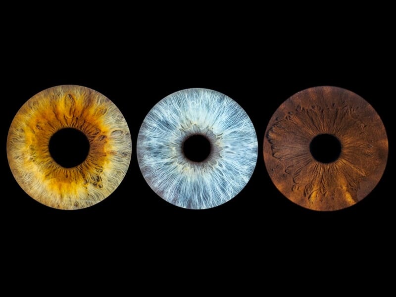 Trois iris alignés, jaune, bleu et marron, sur fond noir, mettant en valeur les détails et textures uniques de chaque œil.