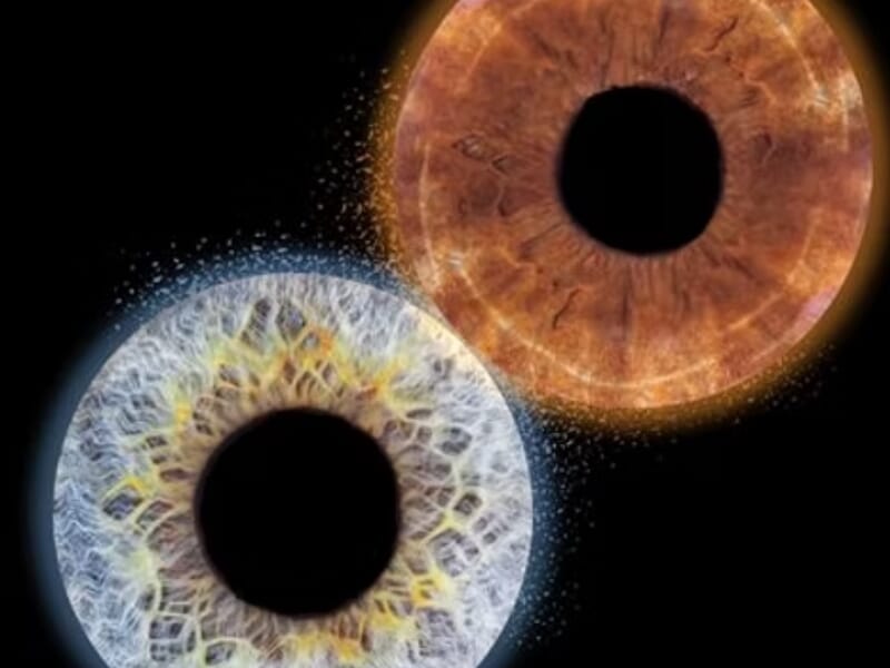 Deux iris en gros plan, un bleu et un marron lors d'un shooting photo iris près de Nancy.