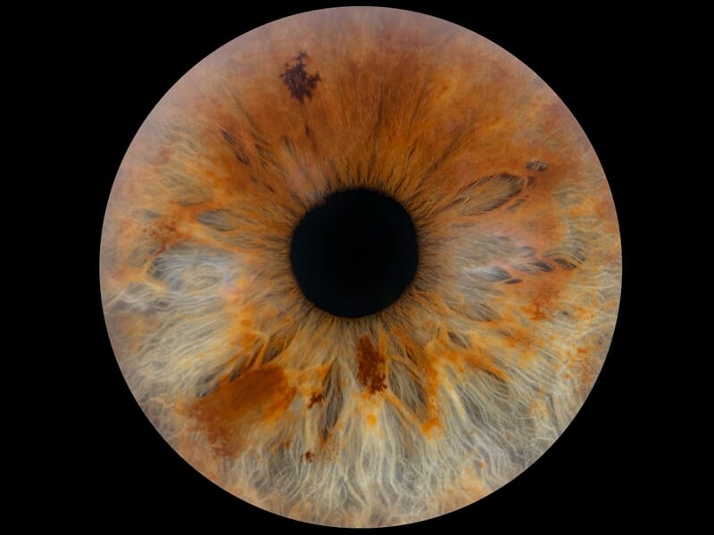 Vue rapprochée d'un iris humain marron avec des nuances orange et des motifs complexes autour de la pupille noire