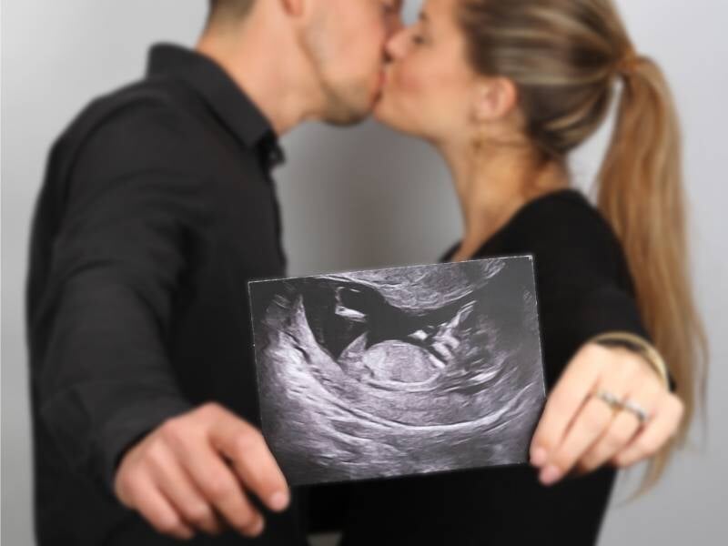 Un couple s'embrasse tendrement, tenant une échographie de bébé en avant-plan, lors d'un shooting photo grossesse près d'Arles.